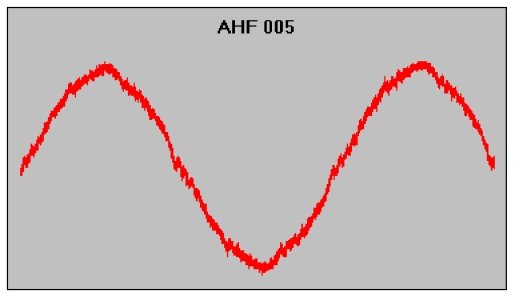 Форма тока с входным фильтром AHF005
